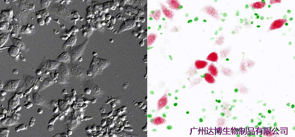 自體自然殺傷細胞注射液（E10H）